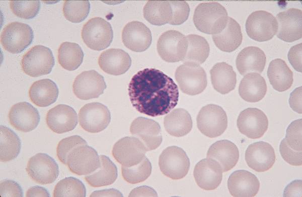 Granulocytes basophiles