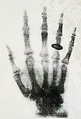 Radiographie, 1895