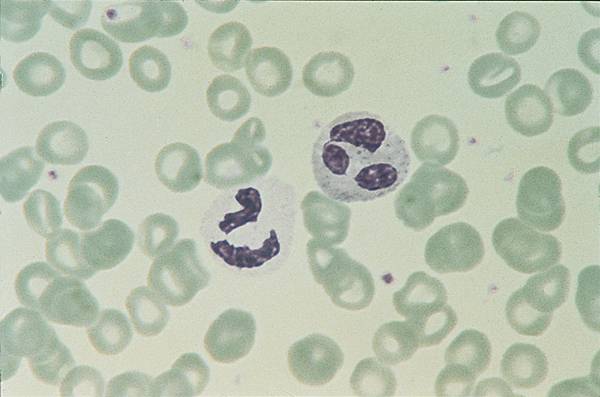 Granulocytes éosinophiles