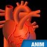 Attaque cardiaque, infarctus du myocarde